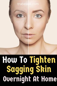 Looking for how to tighten sagging skin, prevention tips, home remedies to fix saggy skin. We have listed homeade face pack Best Homemade Face Mask, Green Tea Face, Saggy Skin, Skin Care Cream, Sagging Skin, Mom Boss, Youthful Skin