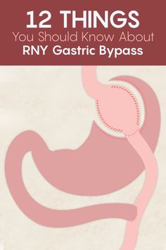 Roux N Y Surgery, Gastric Bypass Meal Plan, Liver Shrinking Diet, Gastric Bypass Sleeve, Bariatric Sleeve