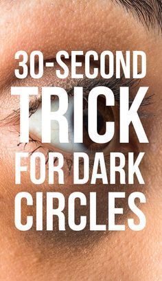 The 30-Second Trick For Getting Rid Of Dark Circles, According To An Expert! Dark circles and under-eye bags are annoying, but you can get rid of them. Find the 30-second trick dermatologists say will help at SheFinds.com! Dry Eyes Causes, Nails Health, Irritated Eye, Eye Infections, Eye Creams, Under Eyes, Eyes Problems, Dark Circle