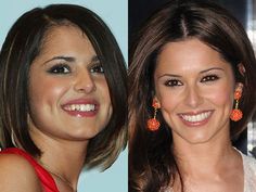 Celebrity Teeth: Before And After Hair Implants, Laser Eye Surgery, Restorative Dentistry, Facial Plastic Surgery, Cheryl Cole