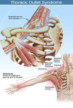 Punkty Spustowe, Muscles Anatomy, Thoracic Outlet, Anatomy Physiology, Medical Anatomy, Hand Therapy