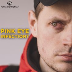 Pink eye (conjunctivitis) is an inflammation or infection of the transparent membrane (conjunctiva) that lines your eyelid and covers the white part of your eyeball. When small blood vessels in the conjunctiva become inflamed, they're more visible. . 𝐎𝐩𝐞𝐧 𝐃𝐚𝐢𝐥𝐲 9am – 8pm Weekdays 10am – 5pm Saturdays (𝘉𝘺 𝘢𝘱𝘱𝘰𝘪𝘯𝘵𝘮𝘦𝘯𝘵 𝘰𝘯𝘭𝘺!) . 𝐂𝐚𝐥𝐥: (213) 334-4111 𝗕𝗼𝗼𝗸 𝗻𝗼𝘄: Eye Infections, Acute Care, Pink Eye, By Appointment Only, Wellness Center, Healthy Aging, Pink Eyes, Blood Vessels