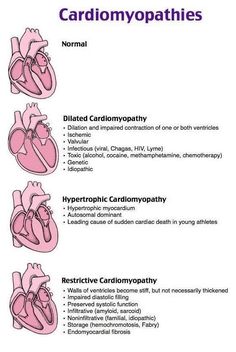 the heart is labeled with different types of cardiompathies and their corresponding functions