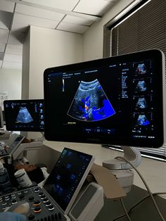 an operating room with multiple monitors and medical equipment on the counter top, including a computer monitor