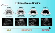 the stages of an endoscopic procedure are shown in black and white, with text describing