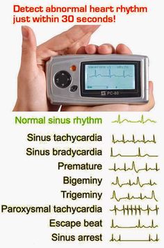 Hemodynamic Monitoring Nursing, Echo Tech Cardiac, Cardiac Monitor Tech, Fetal Heart Monitoring Nursing, Cardiac Perfusion Technology, Normal Sinus Rhythm, Medical Engineering, Biomedical Science, Biomedical Engineering