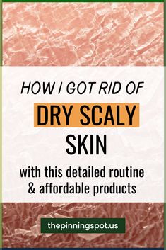 I caused my dry scaly skin trying to get rid of my oily skin. And so to get rid of my dry, scaly skin on face and legs I used this budget-friendly care routine as well as moisturizers to hydrate my skin. These are all the solutions to my dry scaly skin I used, what worked to get rid of my dry scaly skin and what did not work. I hope you find this helpful as you tackle your dry ashy skin. Let's get into it. Skincare Routine For Dry Dull Skin, How To Take Care Of Dry Skin, Skin Care Routine For Very Dry Skin, Get Rid Of Dry Skin On Face, Natural Dry Skin Remedies, Best Dry Skin Products, Skin Care Routine For Sensitive Dry Skin, Scaly Legs Remedy Dry Skin, Flaky Face Skin