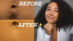 Hey guys in this video I'm sharing tips on getting a hair free stomach. This method is easy long long lasting, pain free, cheap, and helps the hair grow back... Stomach Hair, Shaving Or Waxing, Hair Removal Women, Remove Hair, Body Hair Removal, Lip Hair