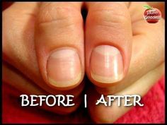 Welcome to my blog: http://coloredtips.com/Follow me on Twitter: https://twitter.com/IdunnGoddessFollow me on G+ : https://plus.google.com/+Coloredtips1/Welc... Nails Step By Step How To Do, How To Do Cuticles At Home, How To Do Manicure At Home Step By Step, Easy Manicure At Home, How To Cut Cuticles, How To Cut Cuticles At Home, How To Do Manicure, Fingernail Health, Gel Manicure Designs