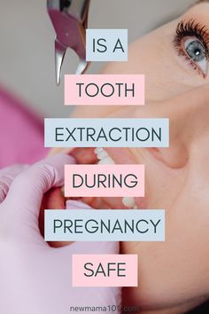 tooth extraction during pregnancy Tooth Pain, Tooth Extraction, First Trimester, Trying To Conceive, Pregnancy Tips