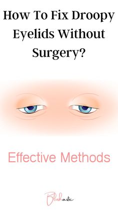 Though there are various surgical methods to fix these droopy eyelids, some people might not prefer going under the knife. If you are in this situation too and wonder, ‘How to fix droopy eyelids without surgery?’ then you are at the right place. Fix Droopy Eyelids, Saggy Cheeks, Eyelid Makeup