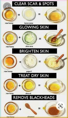 Best skin care home remedies, home remedies for girls, Glowing and brighten skin home remedies for girls, remove blackheads mask Face Mask For Pimples, Remedies For Glowing Skin, Home Remedies For Pimples, Skin Care Home Remedies, Honey Yogurt, Pimples Remedies, Clear Skin Face, Skin Face Mask