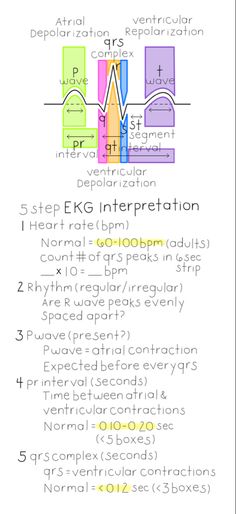 Nursing, nurse, nursing notes, rn, registerednurse, cardiovascular system, cardio, ekg, ekg interpretation, cheat sheet, study notes Ekg Nursing Cheat Sheets, Ekg Notes Cheat Sheets, 3 Lead Ekg Placement, Lethal Rhythms Ekg, Ekg Basics Nursing, Ekg For Dummies, Ekg Notes Nursing Students, Ekg Reading Cheat Sheets, Easy Ekg Interpretation Cheat Sheets