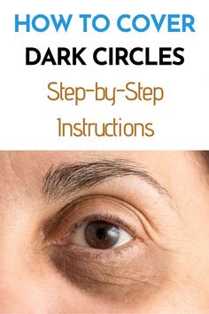 Insufficient sleep and too much stress are the most common causes of dark circles. How to cover dark circles? We have the best tips. Under Eye Dark Circles Over 50, Diy Dark Under Eye Circles, Dark Circles Cover Up Make Up, What To Do For Dark Circles Under Eyes, Dark Undereye Circles Remedies, Best Way To Cover Dark Under Eye Circles, Make Up For Dark Circles Under Eyes