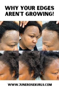 How To Grow Hair Edges Back Fast, African Hair Products For Hair Growth, Natural Hair Edges Growth Tips, Edge Growth For Natural Hair, Hair Edges Growth Tips, Hers Hair Growth, How To Grow Back Edges, Natural Hair Styles For Black Women Thinning Edges, How To Grow Edges Back Fast Naturally