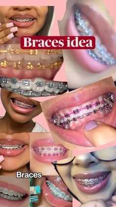 Pink Braces, Braces Girls