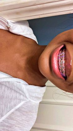 Cute braces, Pink braces, Braces tips, Cute braces colors, Brace face, Braces colors Braces Colors Pink, Braces Pink, Pink Braces, Cute Braces Colors, Braces Tips, Brace Face, Face Cute