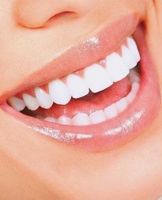 Manifestation Results, How To Make Yellow, Natural Teeth Whitening Diy, Strong Teeth, Teeth Whitening Diy, Beautiful Teeth, Tooth Removal, Perfect Teeth, Yellow Teeth