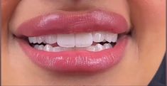 Nice Smile Teeth, Natural Veneers, Natural Teeth Whitening Remedies, Lips Inspiration, Skin Tone Makeup