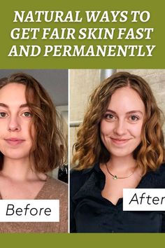 How to make your face whiter Whitening Face, Fresh Hair, Fair Skin, Aloe Vera Gel, Face Skin, Home Remedies, Aloe Vera, Skin Care Tips, Skin Tones