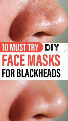 Face Masks For Blackheads, Masks For Blackheads, Removing Blackheads, For Blackheads, Face Mask For Blackheads, Black Head Remover Mask, Blackhead Mask, Black Heads, Natural Sleep Remedies