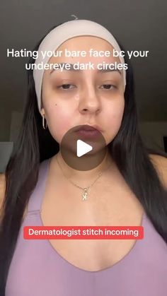 Dr. Neera Nathan on Instagram: "How to fade dark circles at home from a dermatologist.

There ARE affordable products that can improve dark undereye circles, but you will get the best results by picking a product that contains actives that target your type of dark circle.

Pigmented dark circles. These are often hereditary or genetic and common in people with deeper skin tones, but can be improved by using eye creams with brightening actives, like vitamin C, resorcinol, bakuchiol or glutathione (like Ole Henriksen Banana Bright Eye Cream, La Roche-Posay Pigmentclar Eyes, Tatcha The Brightening Eye Cream OR Andalou Naturals Rejuvenating Eye Balm). If you have pigmented dark circles, applying sunscreen under your eyes daily is critical to helping fade their appearance.

Vascular dark circles