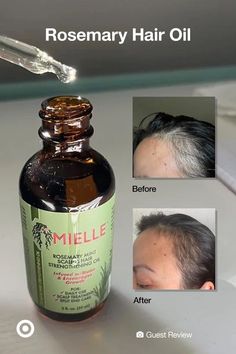 Best Way To Sleep With Hair, Bald Hair Styles, Hair Lossing Tips, Hair Growth Tips For Black Women, Good Hair Products, Rosemary Water For Hair Growth, Rosemary Hair Oil, Rosemary Oil For Hair Growth, Rosemary Hair