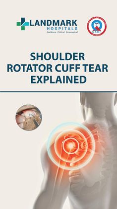 Get to read on all about Shoulder Rotator Cuff Tear here. Rotator Cuff Tear, Rotator Cuff Injury, Shoulder Surgery, Shoulder Support, Rotator Cuff, Health Care Services, Scar Tissue, Hyderabad, Surgery