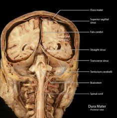 an image of the inside of a human head with labels in english and spanish on it