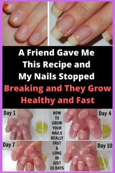 A FRIEND GAVE ME THIS RECIPE AND MY NAILS STOPPED BREAKING AND THEY GROW HEALTHY AND FAST Make Nails Grow, Grow Long Nails, Nail Growth Tips, Natural Nail Care, Health Signs, Tongue Health, Nagel Tips, Nail Care Tips, How To Grow Nails