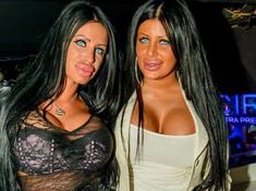 Womens Hair Style, Bad Plastic Surgeries, Bulbous Nose, Plastic Surgery Fail, Plastic Surgery Gone Wrong, Girls When, Selfie Fail, Womens Hair, Celebrity Plastic Surgery