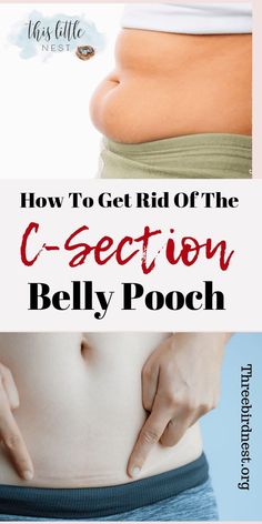 how to get rid of the c section belly pooch