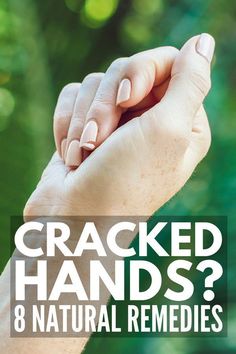 Extremely Dry Hands, Dry Cracked Hands, Contour Tutorial, Contour Makeup Tutorial, Cracked Hands, Prom Makeup Looks, Fall Makeup Looks, Diy Remedies, Winter Makeup