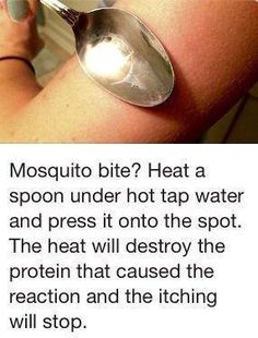 Remedies For Mosquito Bites, 1000 Lifehacks, Nyttige Tips, Mosquito Bites, Survival Skills Life Hacks, Mosquito Bite, Survival Life