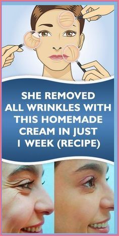 Homemade Wrinkle Cream, Skin Care Wrinkles, Saggy Skin, Anti Wrinkle Cream, Anti Aging Treatments, Wrinkle Cream, Wrinkle Remover, Facial Skin, One Week