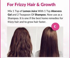 Homemade Hair Treatments, Hair Care Remedies, Natural Skin Care Remedies, Long Hair Tips, Clear Healthy Skin, Natural Face Skin Care, Good Skin Tips, Homemade Hair