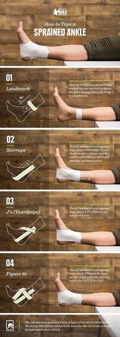 Anti Aging Cream Recipe, Anti Aging Quotes, Aging Quotes, Anti Aging Creme, Survival Life Hacks, Sprained Ankle, Trening Fitness, Survival Life, Anti Aging Beauty