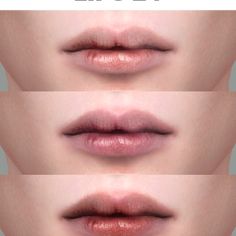 three images of lips with different stages of lip fillers