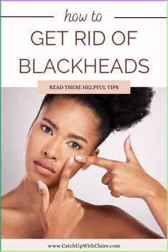 Blackheads are a common skin concerns and this is everything you need to know to get rid of them and prevent them from returning #spot #blackheads #blackheadspopping #blackheadsremover #blackheadremoval #blackheadremedy #blackheadremovalremedies #removeblackheads #skin #skincare #beautyblog #catchupwithclaire Blackheads On Cheeks, Remove Blackheads From Nose, Blackhead Remedies, Rid Of Blackheads, Black Heads, Blackhead Mask, Clean Blackheads, Face Care Routine, Nose Mask