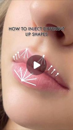 Botox For Headaches, Different Lip Shapes, 1ml Lip Filler, Juvederm Lips, Esthetician Inspiration, Heart Shaped Lips, Botox Cosmetic, Botox Face