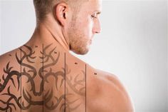 Tattoo Removal Cost Saskatoon. There are any references about Tattoo Removal Cost Saskatoon in here. you can look below. I hope this article about Tattoo Removal Cost Saskatoon can be useful for you. Please remember that this article is for reference purposes only. #tattoo #removal #cost #saskatoon 27 Tattoo, Tattoo Removal Cream, Tattoo Removal Cost, Catrina Tattoo, Tattoo Cream, Laser Removal, Laser Tattoo, About Tattoo, Laser Tattoo Removal