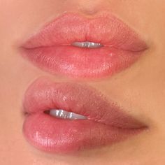 Medium Size Lips, Soft Lip Filler, Natural Lip Blushing, Lip Filler Natural Look, Natural Lips Aesthetic, Lip Filler Inspiration 1ml, Pout Lip Filler, Perfect Lips Aesthetic