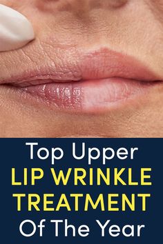 Upper Lip Wrinkles, Duchess Potatoes, Brown Hair With Highlights And Lowlights, Mouth Wrinkles, Skull Handbags, Makeup Tips For Older Women, Face Yoga Facial Exercises, Dark Spots On Face, Lip Wrinkles