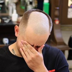 Male Pattern Baldness Hairstyles, Shaving Your Head, Bald Girl