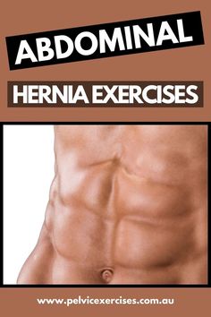 Abdominal hernia exercises for the core abdominal muscles that can improve hernia support before or after hernia surgery with Physiotherapist Michelle Kenway Pelvic Exercises, Abdominal Surgery, Abdominal Exercises, Exercise Yoga, Abdominal Muscles