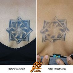 before and after photos of a woman's back tattoo