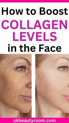 Best Collagen, Skin Lightener, Collagen Benefits, Boost Collagen, Face Wrinkles, Clear Face, Budget Organization, Anti Aging Tips, Skin Care Cream