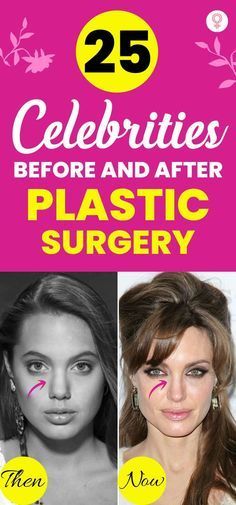 Celeb Plastic Surgery Before And After, Bad Celebrity Plastic Surgery Faces, Celebrity Before And After Surgery, Celebrities Before And After Surgery, Celebrity Plastic Surgery Before After, Celebrity Real Bodies, Plastic Surgery Before And After, Sandra Bullock Plastic Surgery, Kris Jenner Plastic Surgery