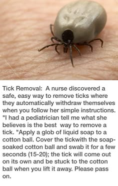 Tick Removal, Camping Checklist, Diy Life Hacks, Survival Tips