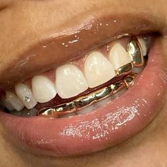 Mouth Grill For Women, Gold Teeth Women, Grills Teeth Men, Silver Grillz Men, Bottom Grills For Women, Fangs Grillz Women, Grills For Women Teeth, Grillz Teeth Men, Gold Teeth Grills